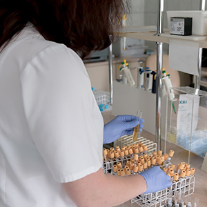 HPLC在臨床實驗室中的潛在應(yīng)用有哪些？